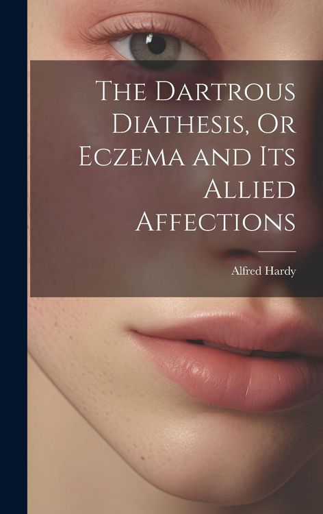Produktbild: The Dartrous Diathesis, Or Eczema and Its Allied Affections