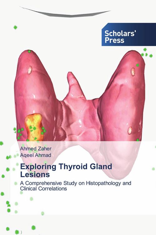 Produktbild: Exploring Thyroid Gland Lesions