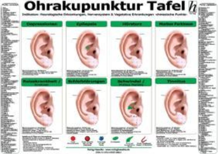 Produktbild: Ohrakupunktur Tafel - Indikation: Neurologische Erkrankungen, Nervensystem & Vegetative Erkrankungen
