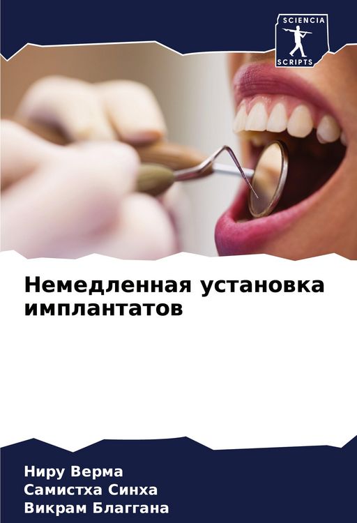 Produktbild: Nemedlennaq ustanowka implantatow