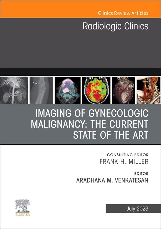 Produktbild: Imaging of Gynecologic Malignancy: The Current State of the Art, an Issue of Radiologic Clinics of North America