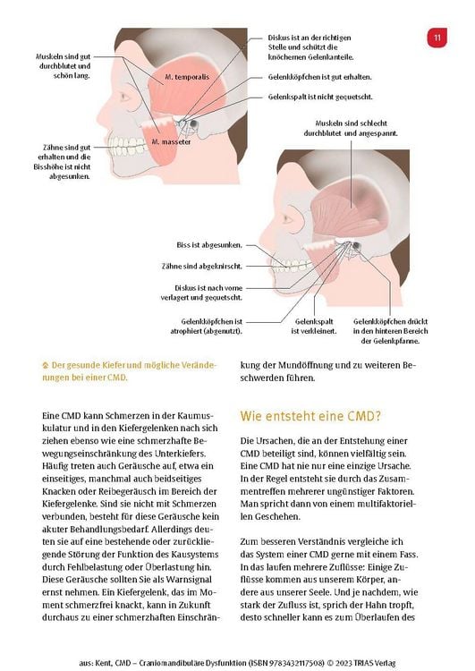 Produktbild: CMD - Craniomandibul&auml;re Dysfunktion