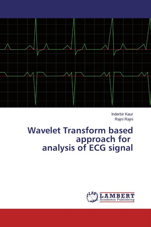 Produktbild: Wavelet Transform based approach for analysis of ECG signal