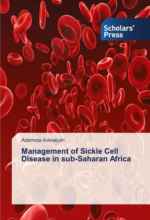 Produktbild: Management of Sickle Cell Disease in sub-Saharan Africa