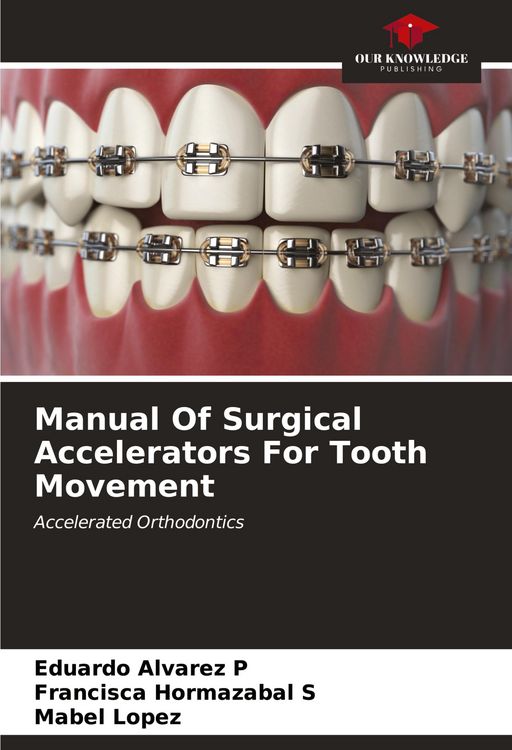 Produktbild: Manual Of Surgical Accelerators For Tooth Movement