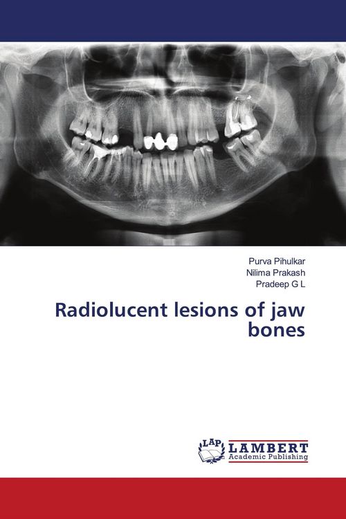 Produktbild: Radiolucent lesions of jaw bones