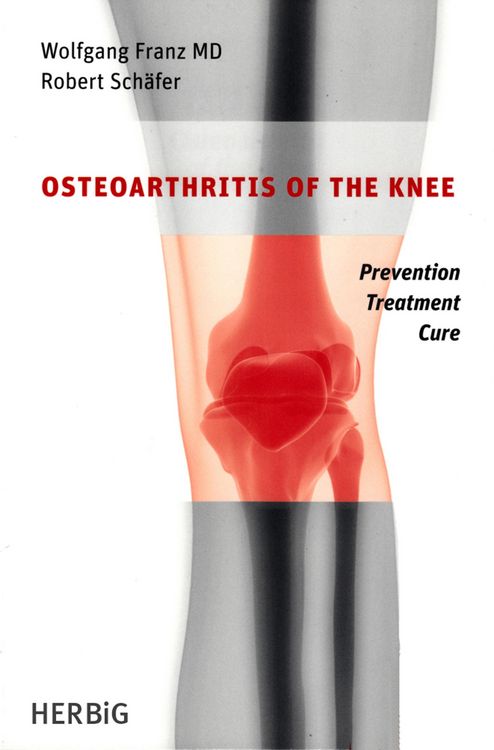 Produktbild: Osteoarthritis of the knee
