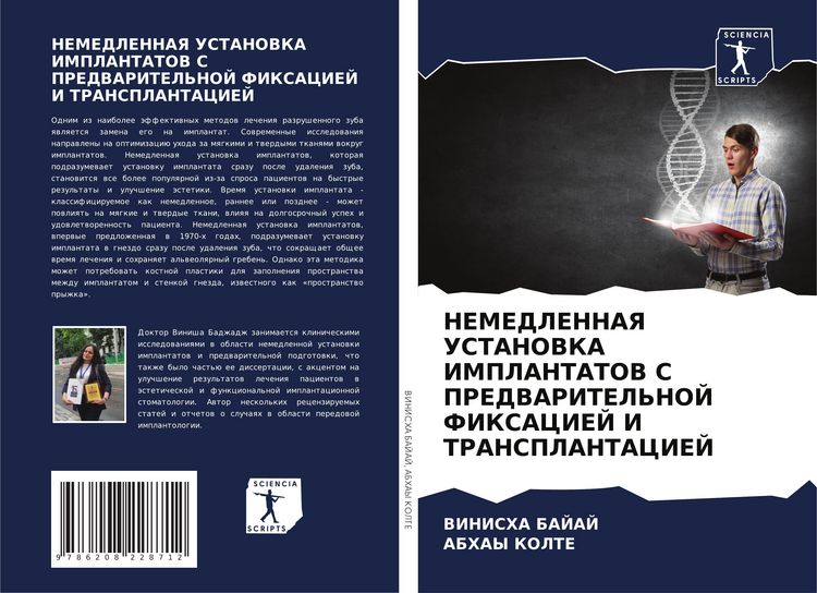 Produktbild: Nemedlennaya Ustanovka Implantatov S Predvaritel'noj Fiksaciej I Transplantaciej