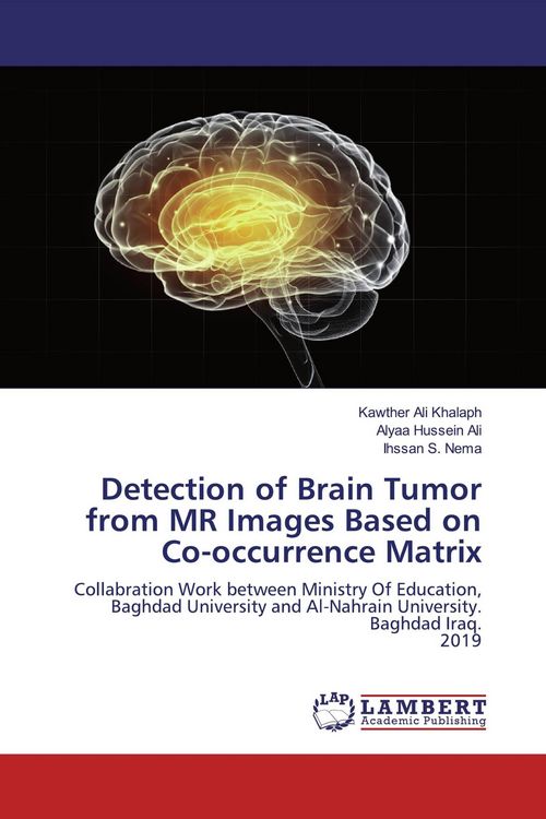 Produktbild: Detection of Brain Tumor from MR Images Based on Co-occurrence Matrix