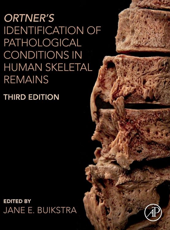 Produktbild: Ortner's Identification of Pathological Conditions in Human Skeletal Remains