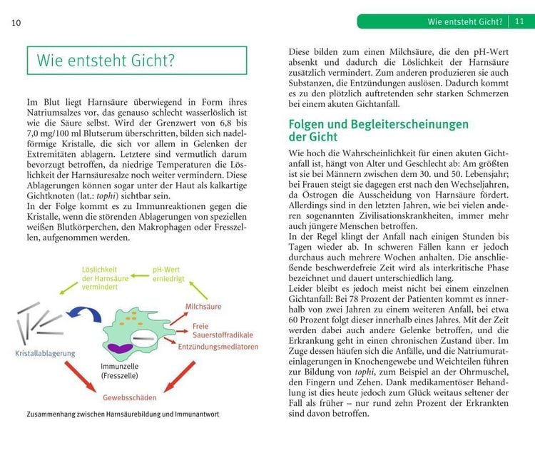 Produktbild: Die richtige Ern&auml;hrung bei Gicht