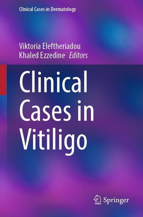 Produktbild: Clinical Cases in Vitiligo