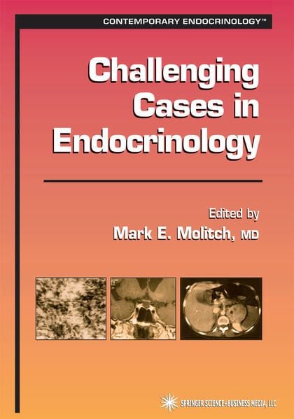 Produktbild: Challenging Cases in Endocrinology