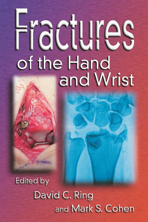Produktbild: Fractures of the Hand and Wrist
