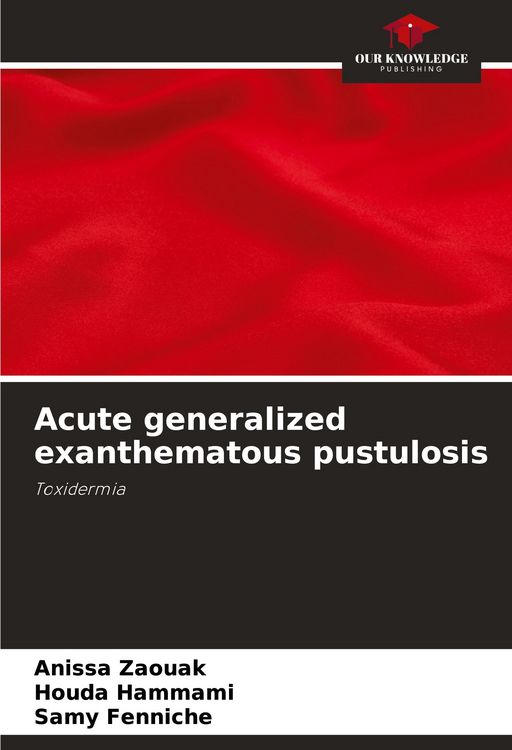 Produktbild: Acute generalized exanthematous pustulosis