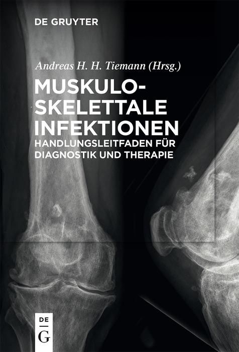 Produktbild: Muskuloskelettale Infektionen