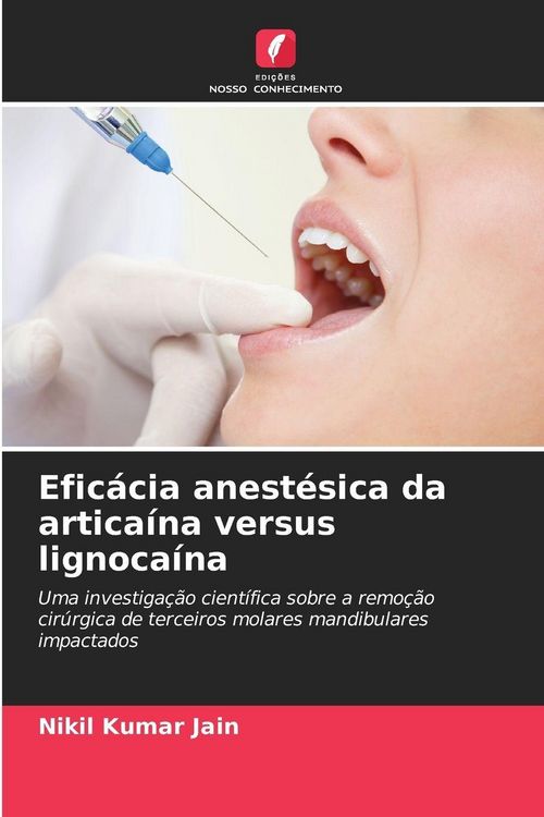 Produktbild: Efic&aacute;cia anest&eacute;sica da artica&iacute;na versus lignoca&iacute;na