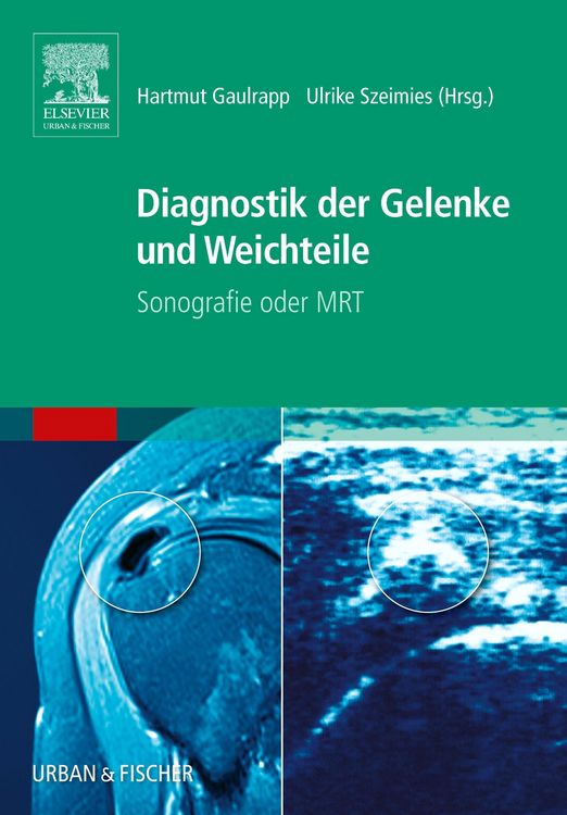 Produktbild: Diagnostik der Gelenke und Weichteile