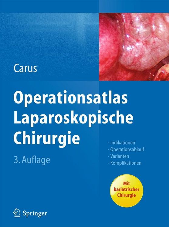 Produktbild: Operationsatlas Laparoskopische Chirurgie