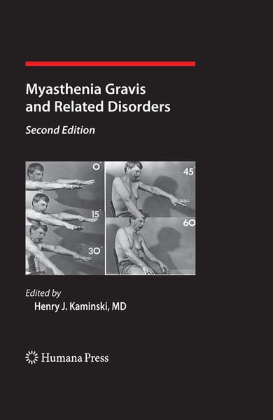 Produktbild: Myasthenia Gravis and Related Disorders