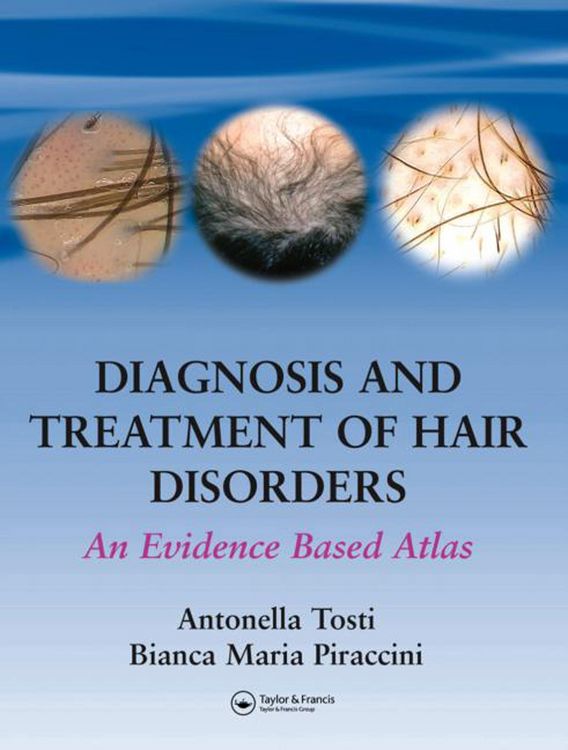 Produktbild: Diagnosis and Treatment of Hair Disorders