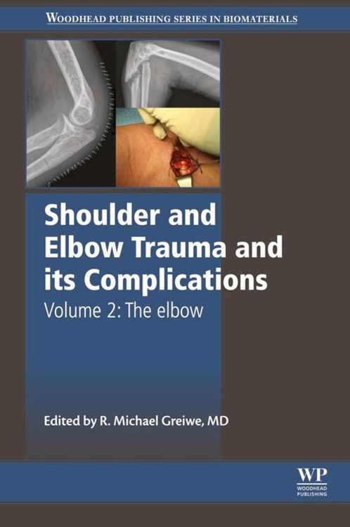 Produktbild: Shoulder and Elbow Trauma and its Complications