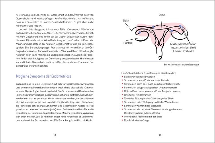Produktbild: Leben mit Endometriose