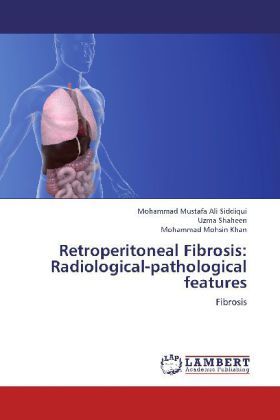 Produktbild: Mustafa Ali Siddiqui, M: Retroperitoneal Fibrosis: Radiologi