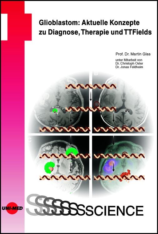 Produktbild: Glioblastom: Aktuelle Konzepte zu Diagnose, Therapie und TTFields