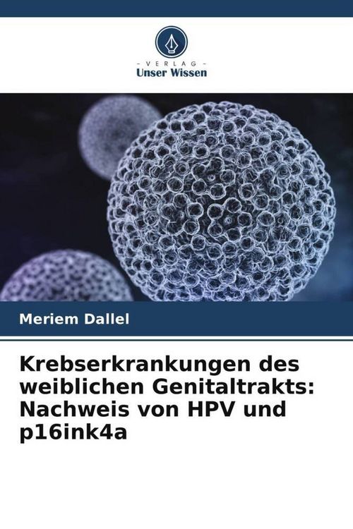 Produktbild: Krebserkrankungen des weiblichen Genitaltrakts: Nachweis von HPV und p16ink4a