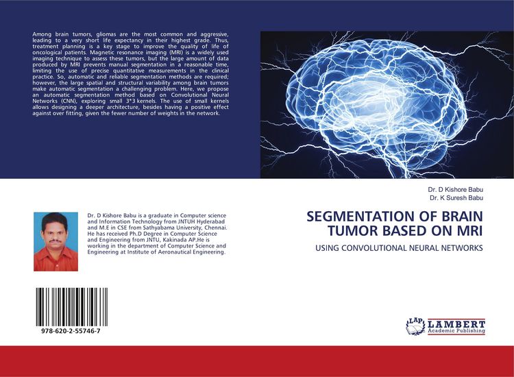 Produktbild: Segmentation Of Brain Tumor Based On Mri