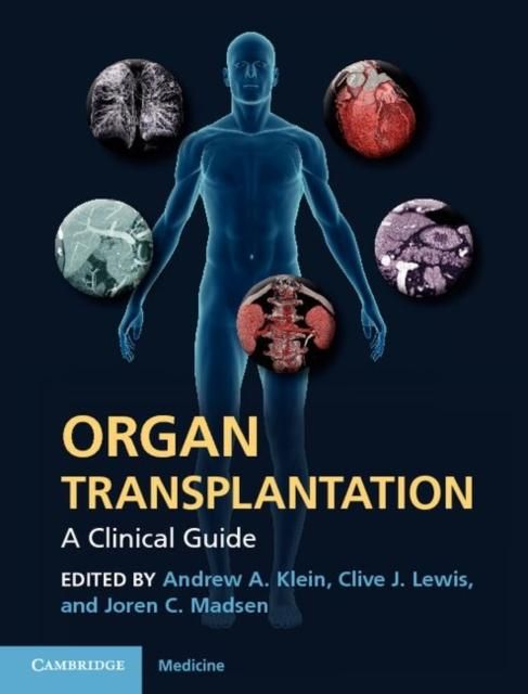 Produktbild: Organ Transplantation