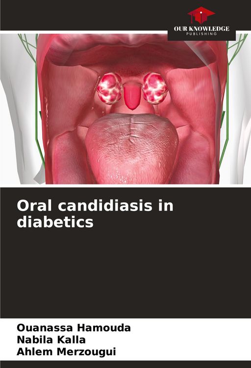 Produktbild: Oral candidiasis in diabetics