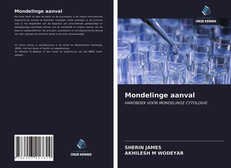 Produktbild: Mondelinge aanval