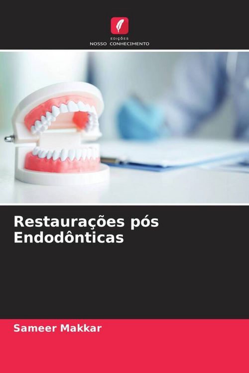Produktbild: Restaura&ccedil;&otilde;es p&oacute;s Endod&ocirc;nticas