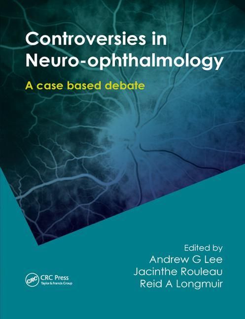 Produktbild: Controversies in Neuro-Ophthalmology