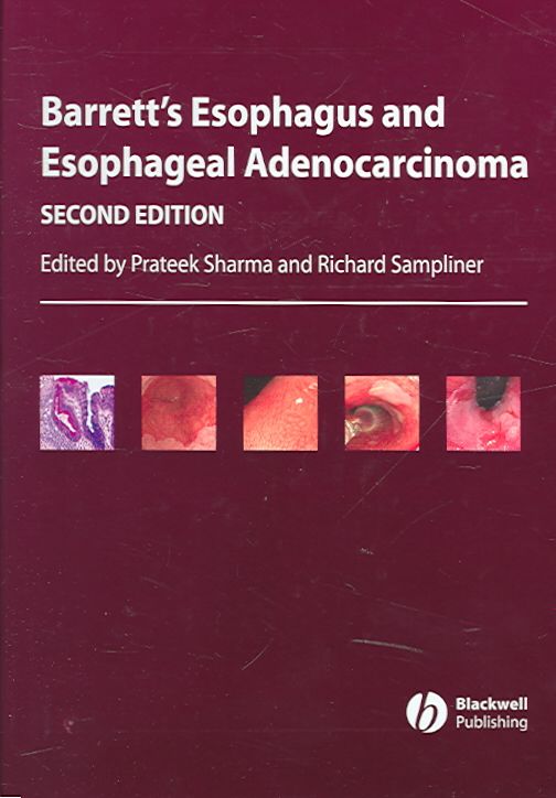 Produktbild: Sharma, P: Barrett&prime;s Esophagus and Esophageal Adenocar