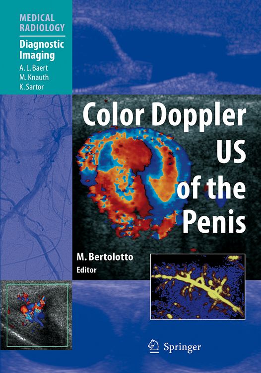 Produktbild: Color Doppler US of the Penis