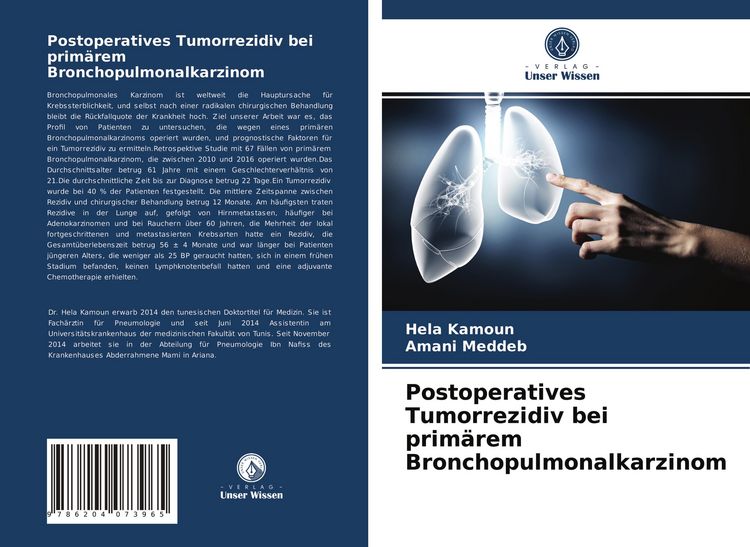 Produktbild: Postoperatives Tumorrezidiv bei prim&auml;rem Bronchopulmonalkarzinom