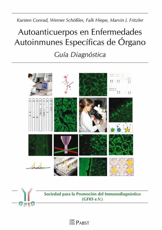 Produktbild: Autoanticuerpos en Enfermedades Autoinmunes Espec&iacute;ficas de &Oacute;rgano - Gu&iacute;a Diagn&oacute;stica