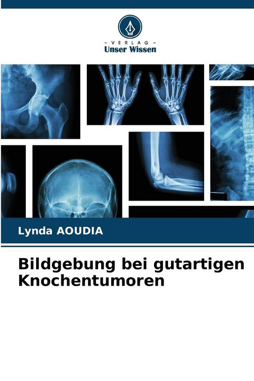 Produktbild: Bildgebung bei gutartigen Knochentumoren