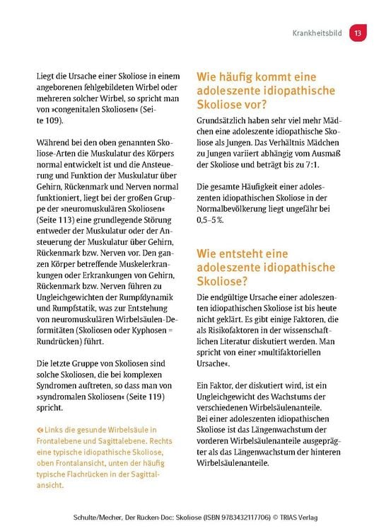 Produktbild: Der R&uuml;cken-Doc: Skoliose