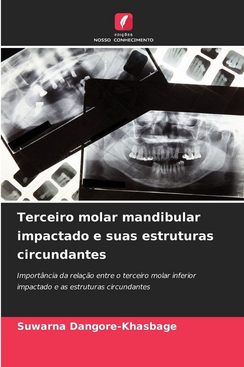 Produktbild: Terceiro molar mandibular impactado e suas estruturas circundantes