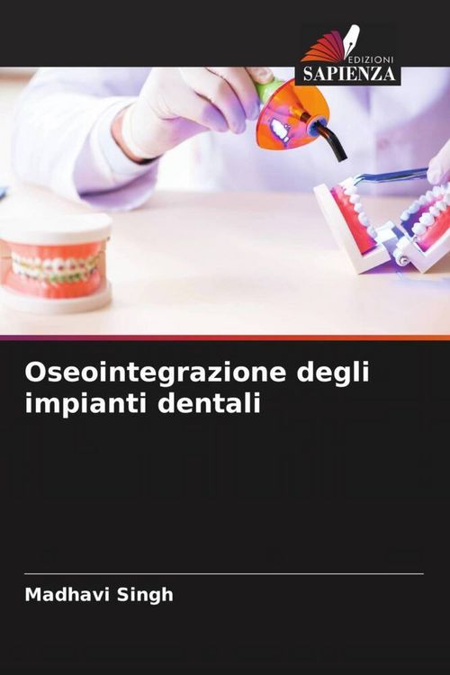 Produktbild: Oseointegrazione degli impianti dentali