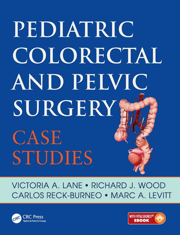 Produktbild: Pediatric Colorectal and Pelvic Surgery
