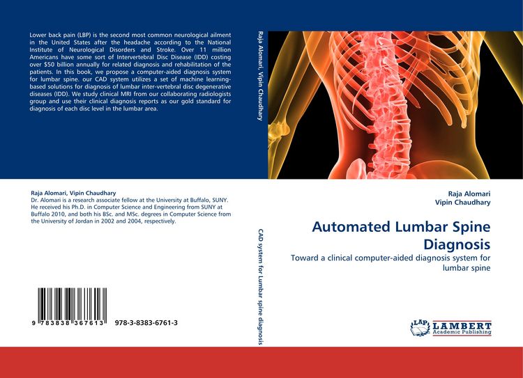 Produktbild: Automated Lumbar Spine Diagnosis