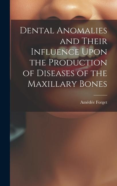 Produktbild: Dental Anomalies and Their Influence Upon the Production of Diseases of the Maxillary Bones