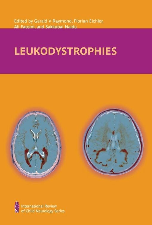 Produktbild: Leukodystrophies
