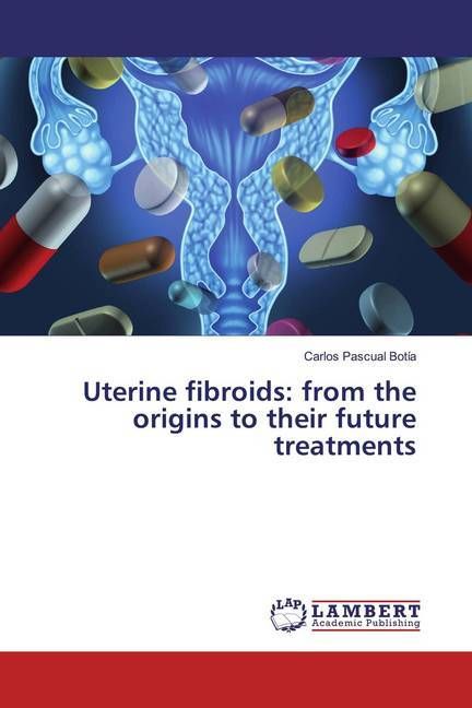 Produktbild: Pascual Bot&iacute;a, C: Uterine fibroids: from the origins to thei