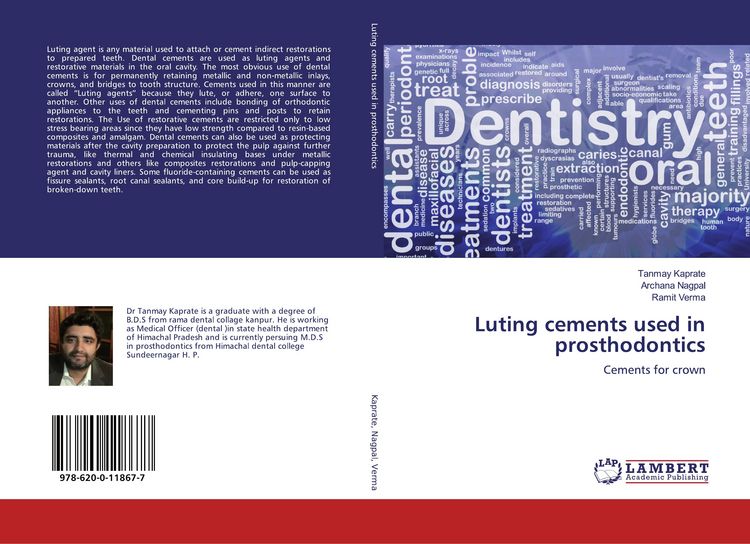 Produktbild: Luting cements used in prosthodontics